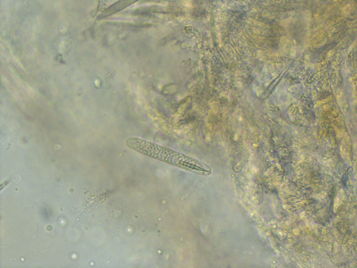 Singola nematocisti di Euphyllia paradivisa, lunga circa 20 micron (20 millesimi di millimetro) Singola nematocisti di Euphyllia paradivisa, lunga circa 20 micron (20 millesimi di millimetro)