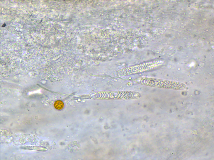 Tre nematocisti di Euphyllia paradivisa. In due si nota il filamento estroflesso Tre nematocisti di Euphyllia paradivisa. In due si nota il filamento estroflesso