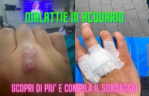 Avete mai avuto problemi di salute per l’acquario? Sondaggio